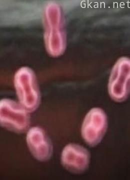 比战争更可怕的杀手