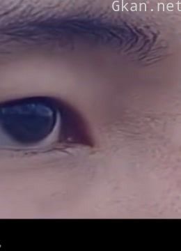 王刚讲故事之眼球里的谜团