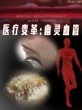医疗变革:幽灵血管