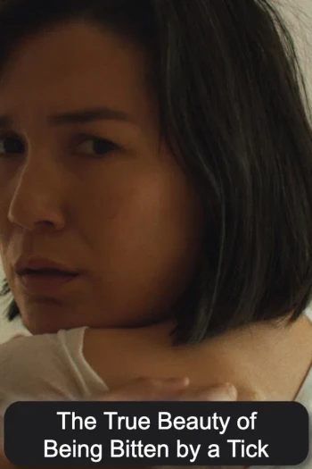 被蜱虫叮咬的真实性